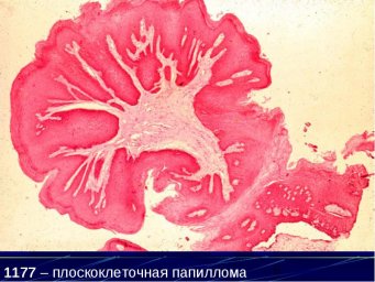 Курсы повышения квалификации врачей по специальности «Патологическая анатомия»